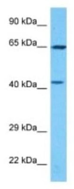 PAPSS2 Rabbit anti-Human, Polyclonal, Novus Biologicals:Antibodies:Primary